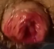 This anal prolapse shows a physical depiction of female isolation in current society.png